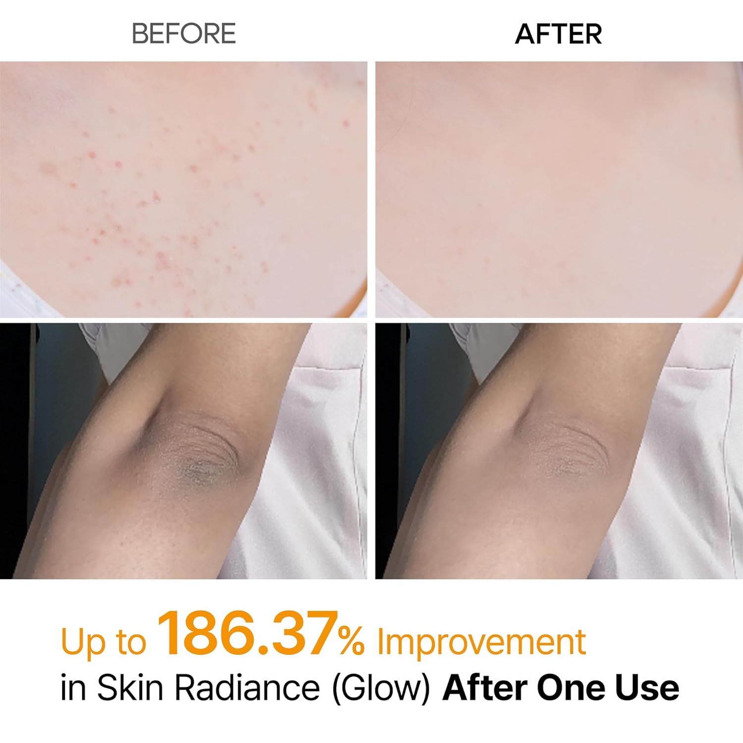 Dr.Melaxin Peel Shot Kojic Acid Turmeric Body Exfoliator Spray 6.76 fl.oz