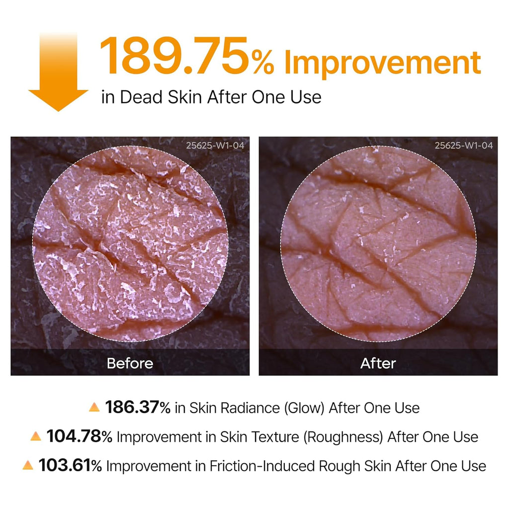 Dr.Melaxin Peel Shot Kojic Acid Turmeric Body Exfoliator Spray 6.76 fl.oz