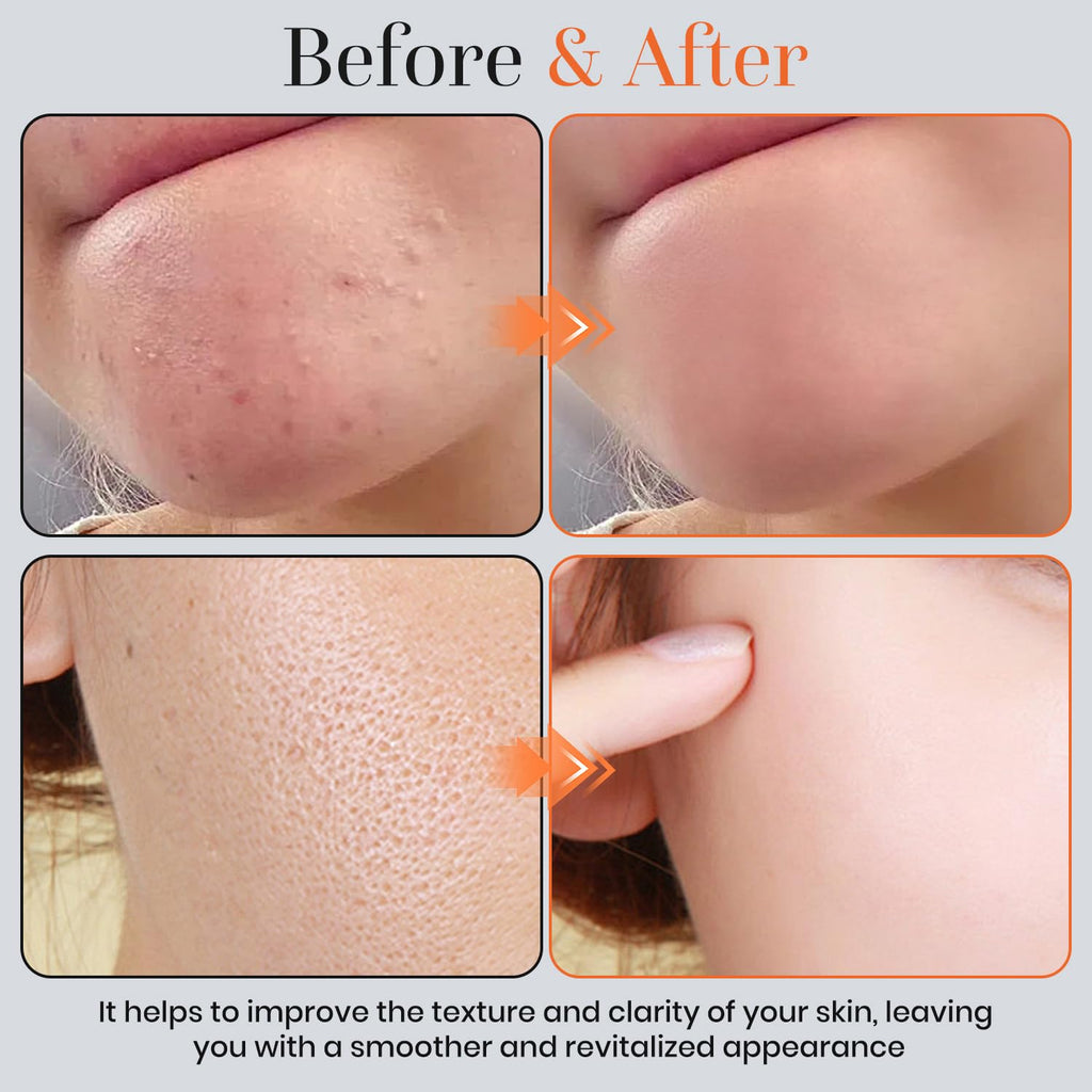 🍊Natural Orange Peeling Gel Face Scrub