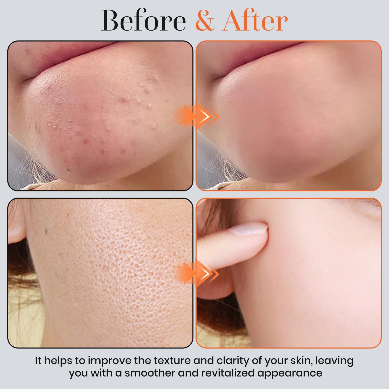 🍊Natural Orange Peeling Gel Face Scrub